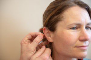 acupuncture in ear 