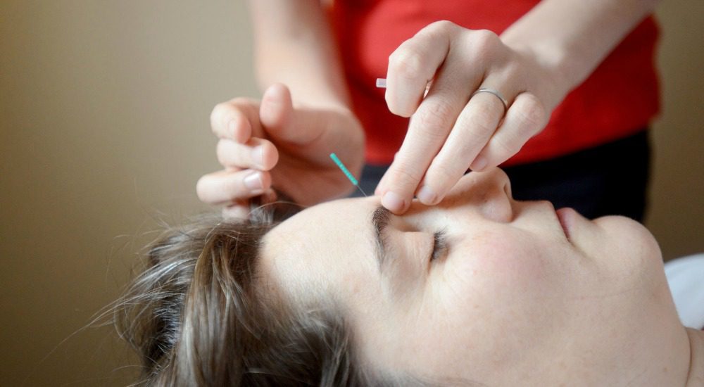 Are There Risks To Acupuncture Facial Rejuvenation?