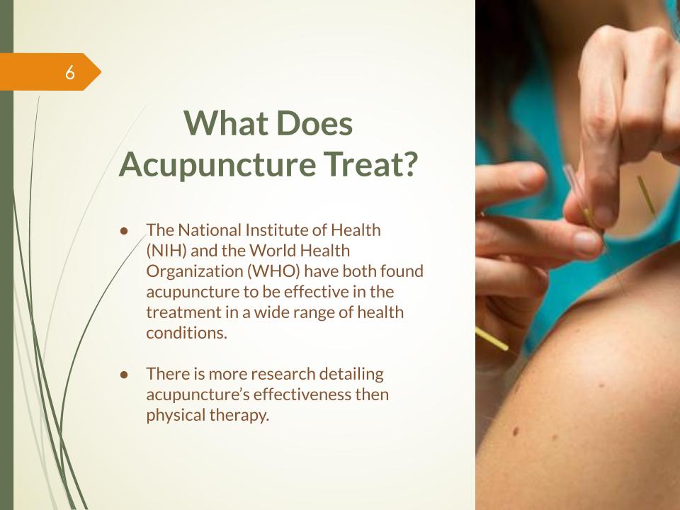 What does Acupuncture treat?