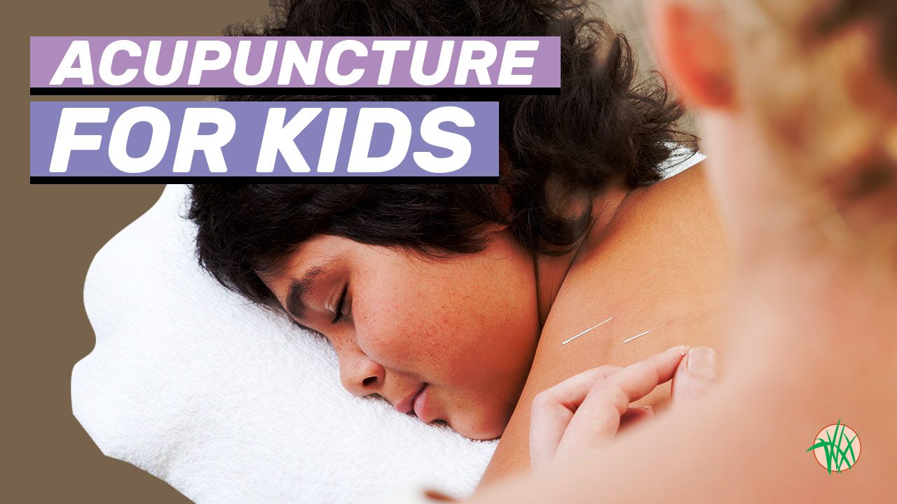Acupuncture for kids. Acupuncturist placing needles into child's shoulder and back