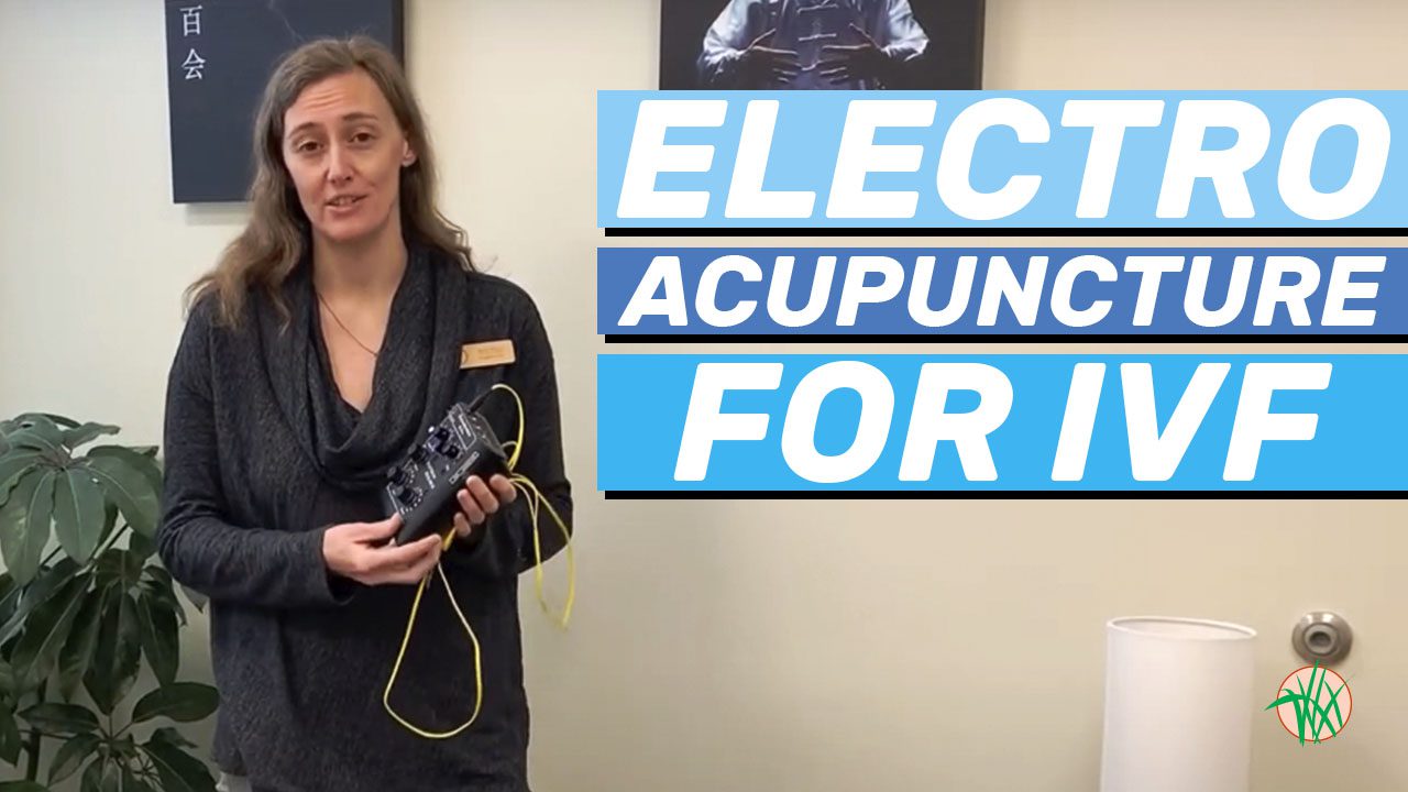 Electroacupuncture for IVF: Kerry holding electro-stimulator