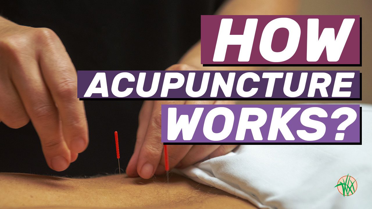 How does acupuncture work? Practitioner placing needles in patient's low back