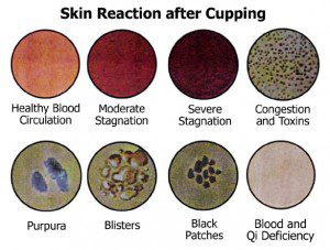 Skin-reaction