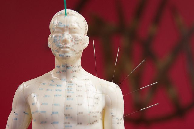 National Acupuncture Day October 24, 2018