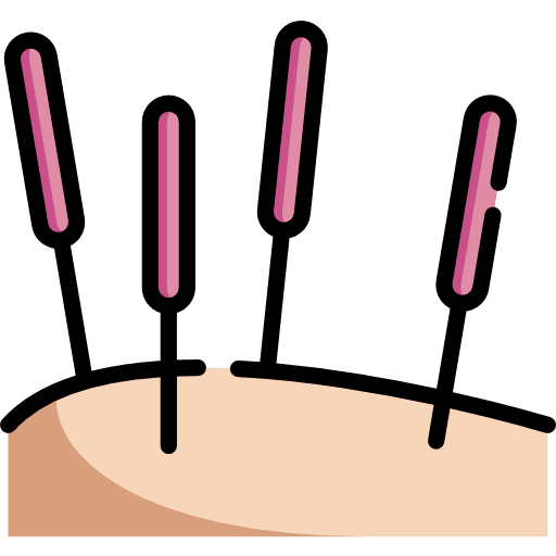 Drawing of 4 acupuncture needles