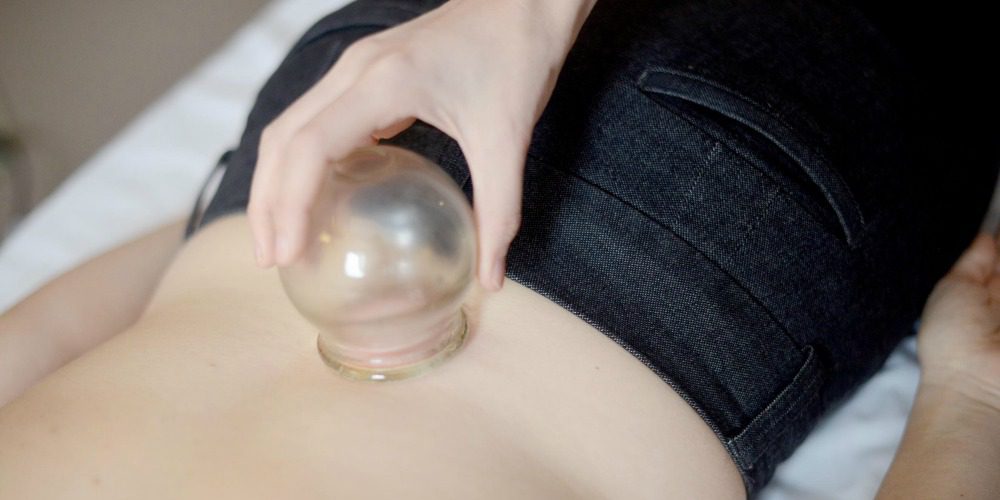 Cupping For Pain Therapy