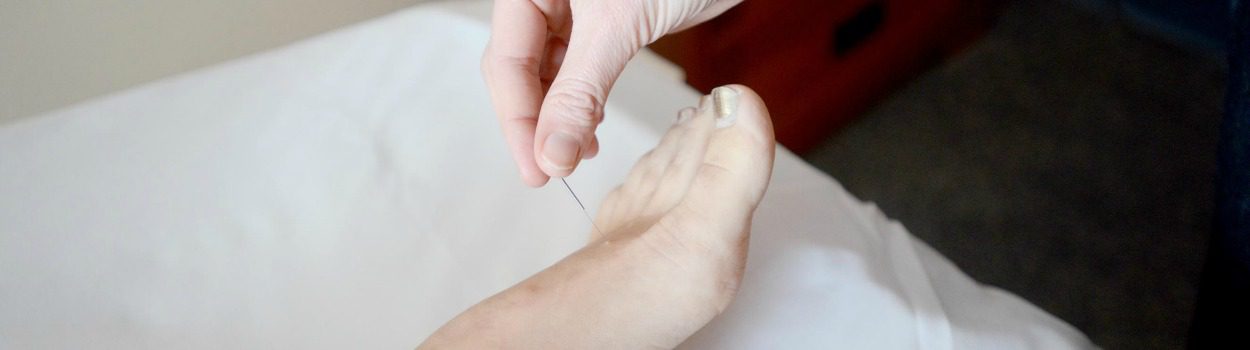 Is Acupuncture Safe?