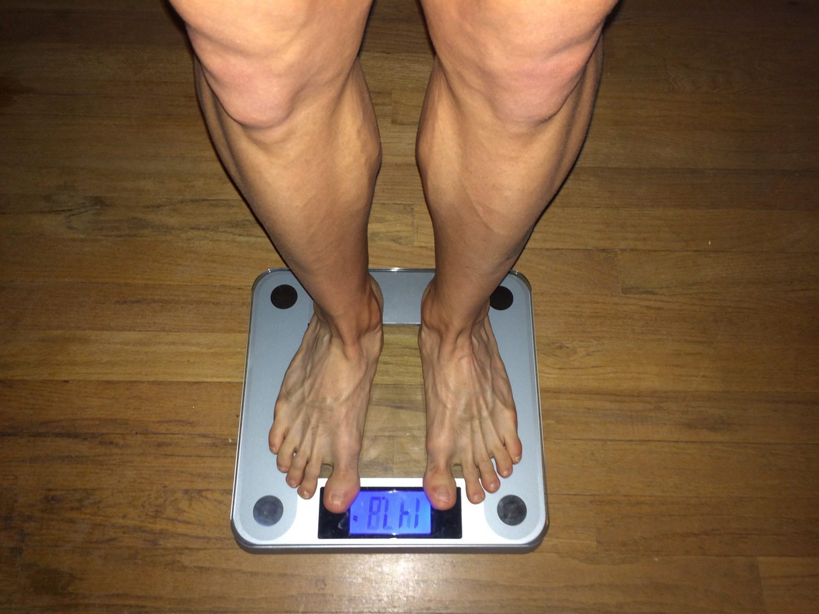 Acupuncture for Weight Loss: Research Update