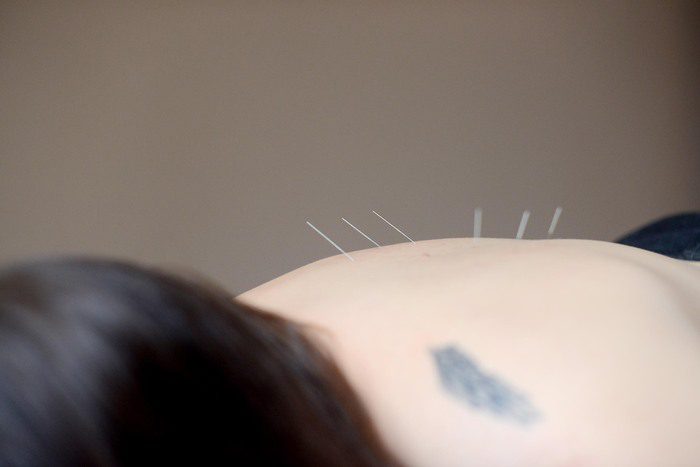 What Are The Risks Of Acupuncture During Cancer Treatment?
