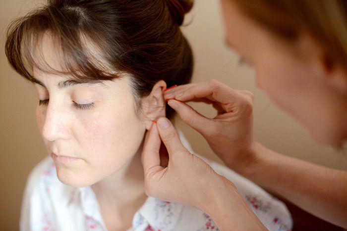 Ear Acupuncture- How Does It Work?